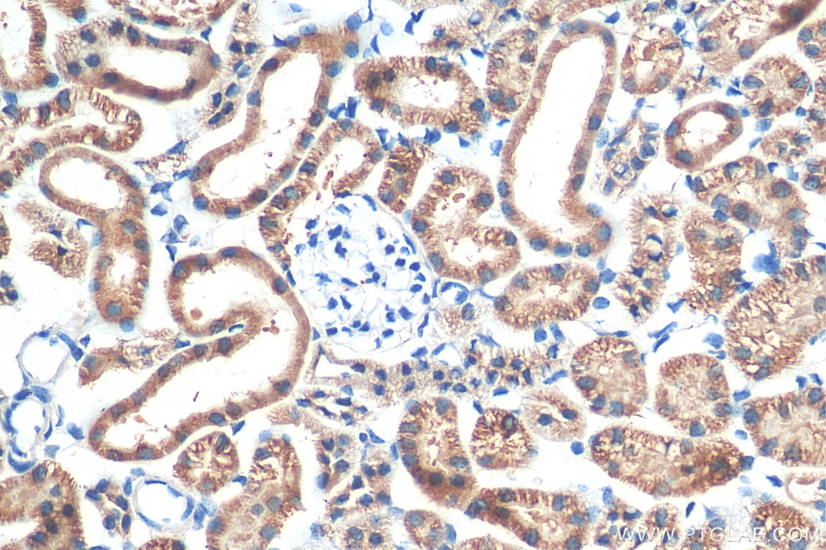Immunohistochemistry (IHC) staining of mouse kidney tissue using Biotin-conjugated PARK7,DJ-1 Polyclonal antibody (Biotin-11681)