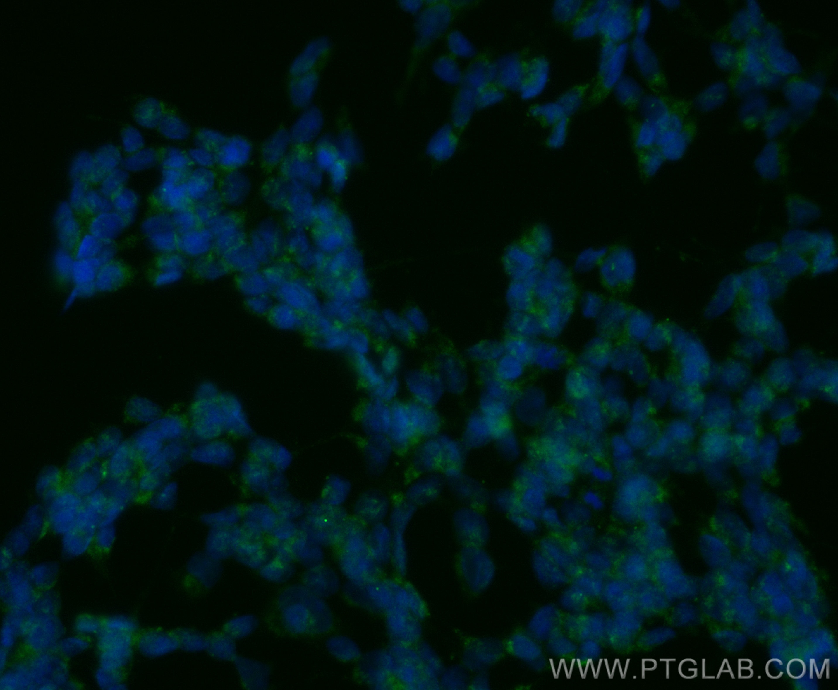 Immunofluorescence (IF) / fluorescent staining of SH-SY5Y cells using CoraLite® Plus 488-conjugated PARK7,DJ-1 Polyclona (CL488-11681)