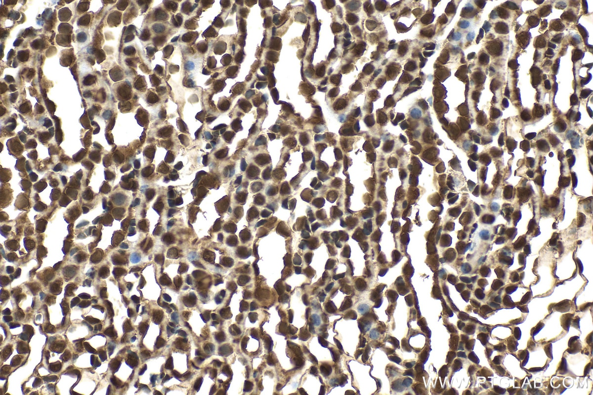 IHC staining of mouse kidney using RMX00059 Immunohistochemistry (IHC) staining of mouse kidney tissue using Multi-rAb® PARK7/DJ-1 Multi-Recombinant antibody (RMX00059)