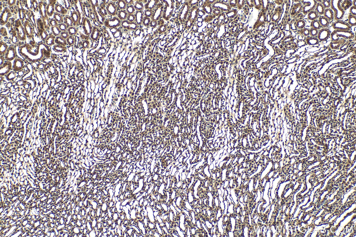 IHC staining of mouse kidney using RMX00059 Immunohistochemistry (IHC) staining of mouse kidney tissue using Multi-rAb® PARK7/DJ-1 Multi-Recombinant antibody (RMX00059)