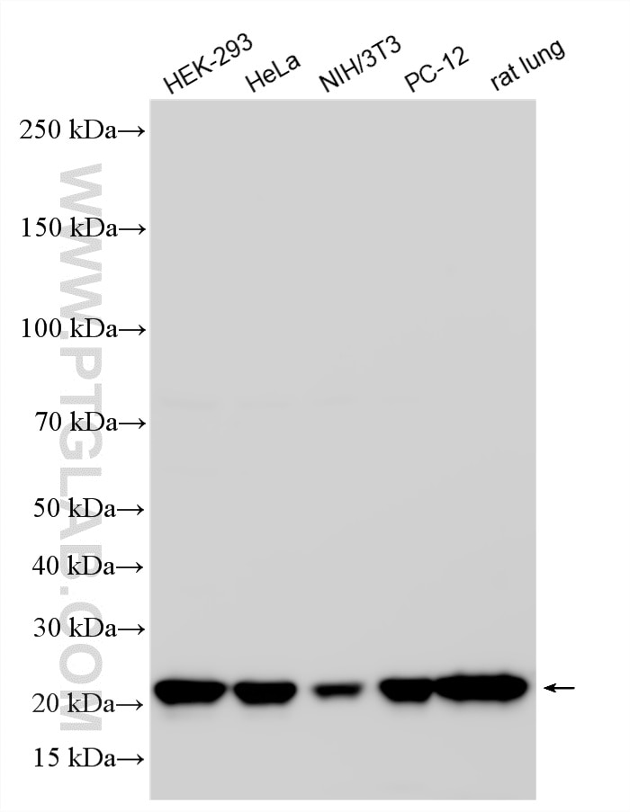WB analysis using RMX00059 Western Blot (WB) analysis of various lysates using Multi-rAb® PARK7/DJ-1 Multi-Recombinant antibody (RMX00059)