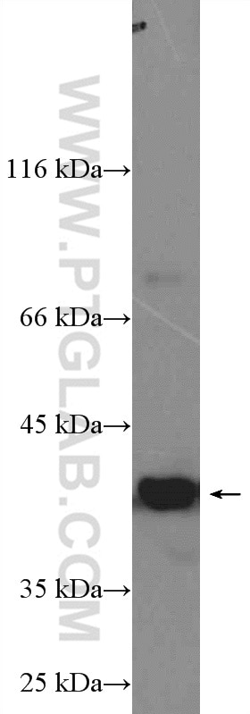 Western Blot (WB) analysis of 3T3-L1 cells using PARL Polyclonal antibody (26679-1-AP)