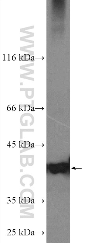 Western Blot (WB) analysis of HEK-293 cells using PARL Polyclonal antibody (26679-1-AP)