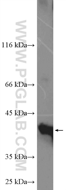 Western Blot (WB) analysis of Neuro-2a cells using PARL Polyclonal antibody (26679-1-AP)