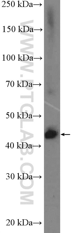 Western Blot (WB) analysis of HeLa cells using PARL Polyclonal antibody (26679-1-AP)
