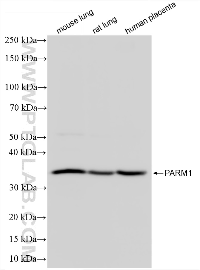 Western Blot (WB) analysis of various lysates using PARM1 Recombinant monoclonal antibody (87241-3-RR)