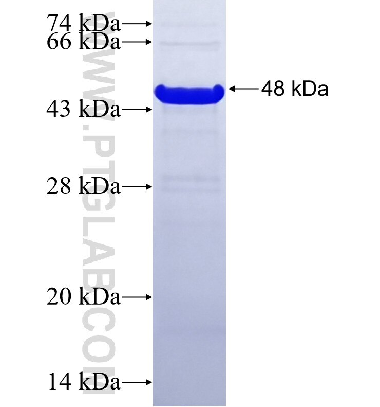 PARM1 fusion protein Ag19992 SDS-PAGE