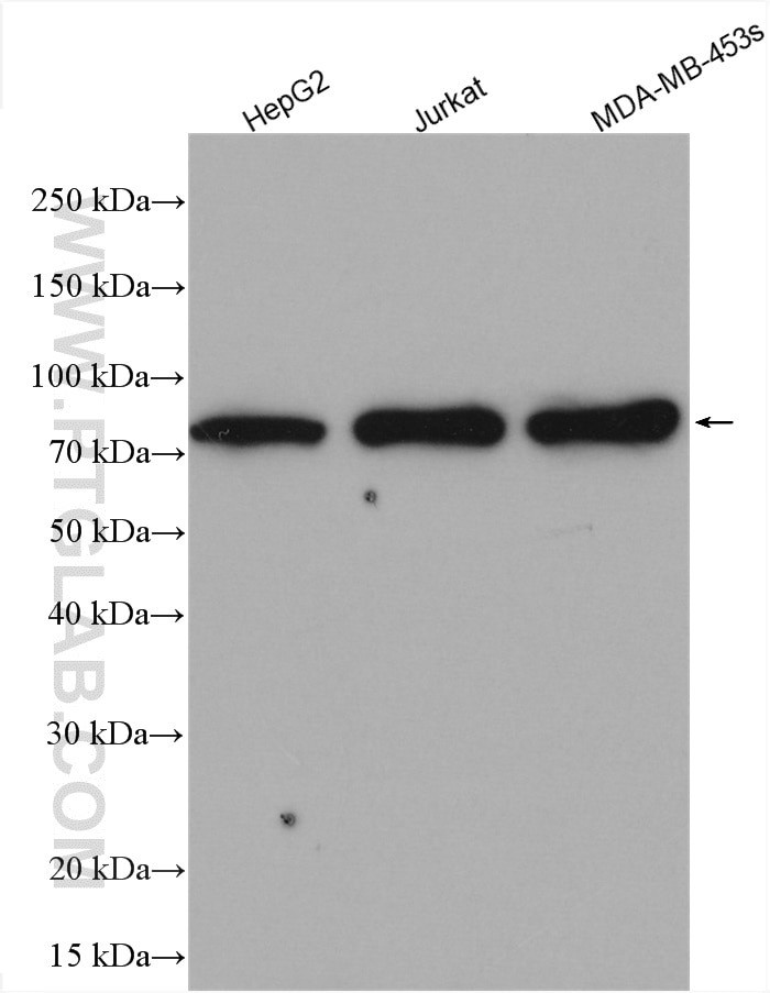 Western Blot (WB) analysis of various lysates using PARN Polyclonal antibody (13799-1-AP)