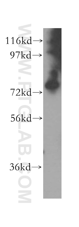 Western Blot (WB) analysis of human cerebellum tissue using PARN Polyclonal antibody (13799-1-AP)