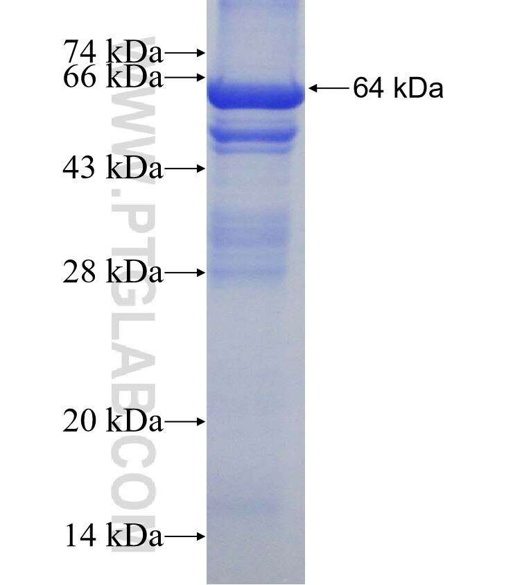 PARN fusion protein Ag4774 SDS-PAGE