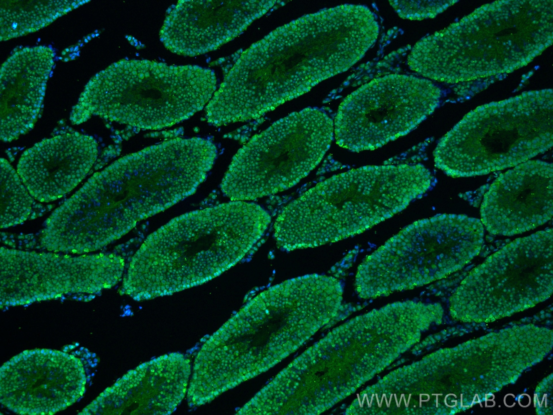 IF Staining of mouse testis using 13371-1-AP