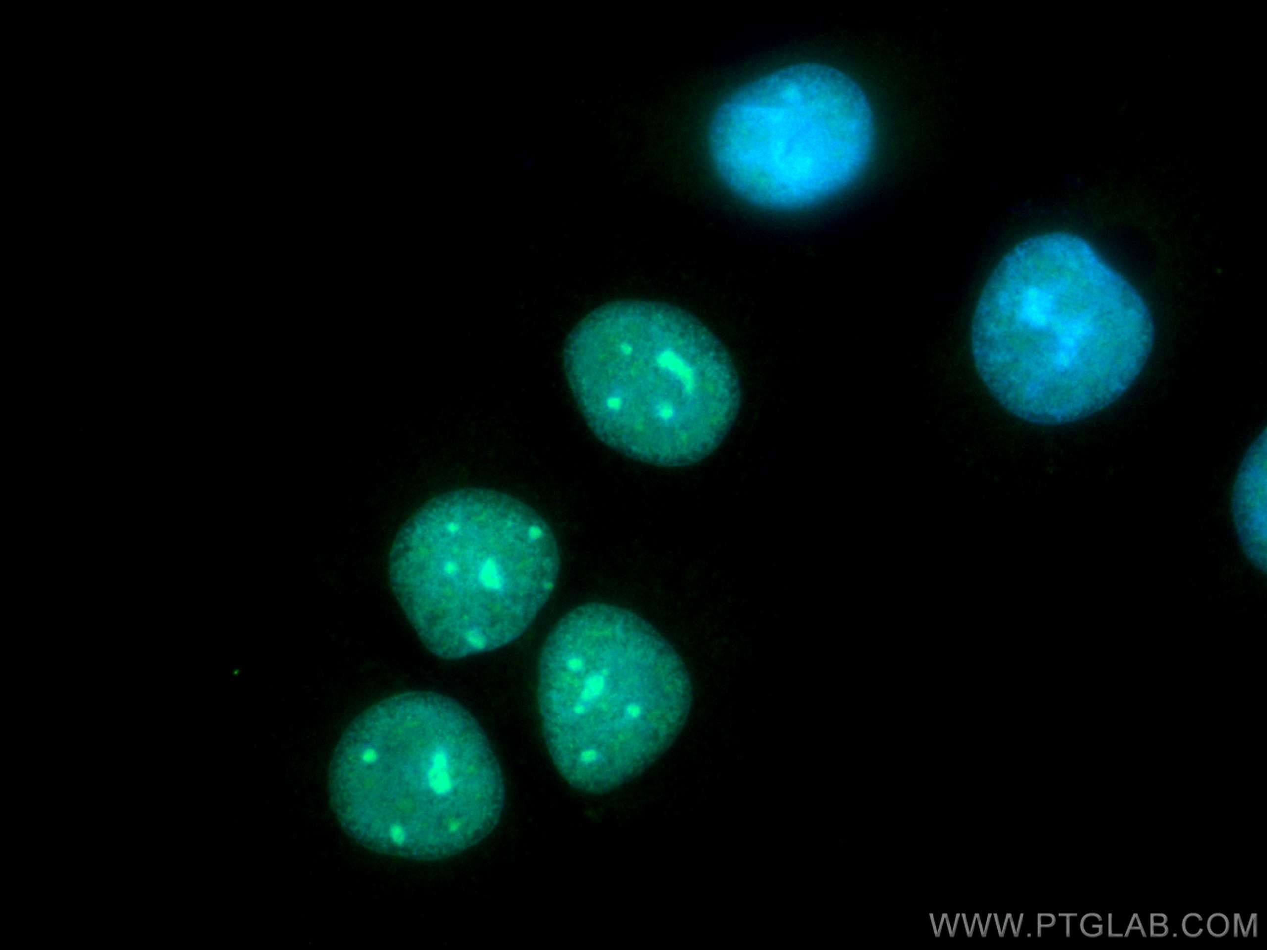 Immunofluorescence (IF) / fluorescent staining of MCF-7 cells using PARP1 Polyclonal antibody (13371-1-AP)
