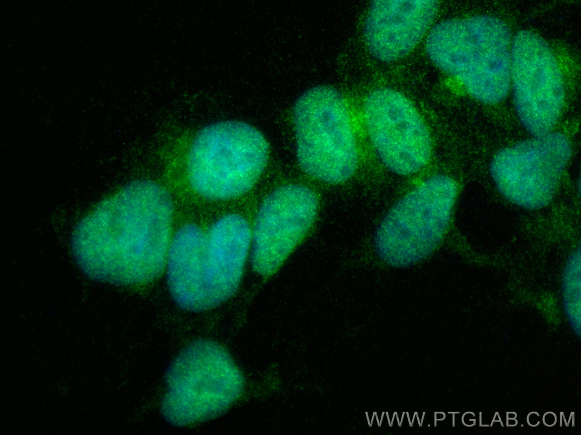 Immunofluorescence (IF) / fluorescent staining of HEK-293 cells using PARP1 Polyclonal antibody (13371-1-AP)