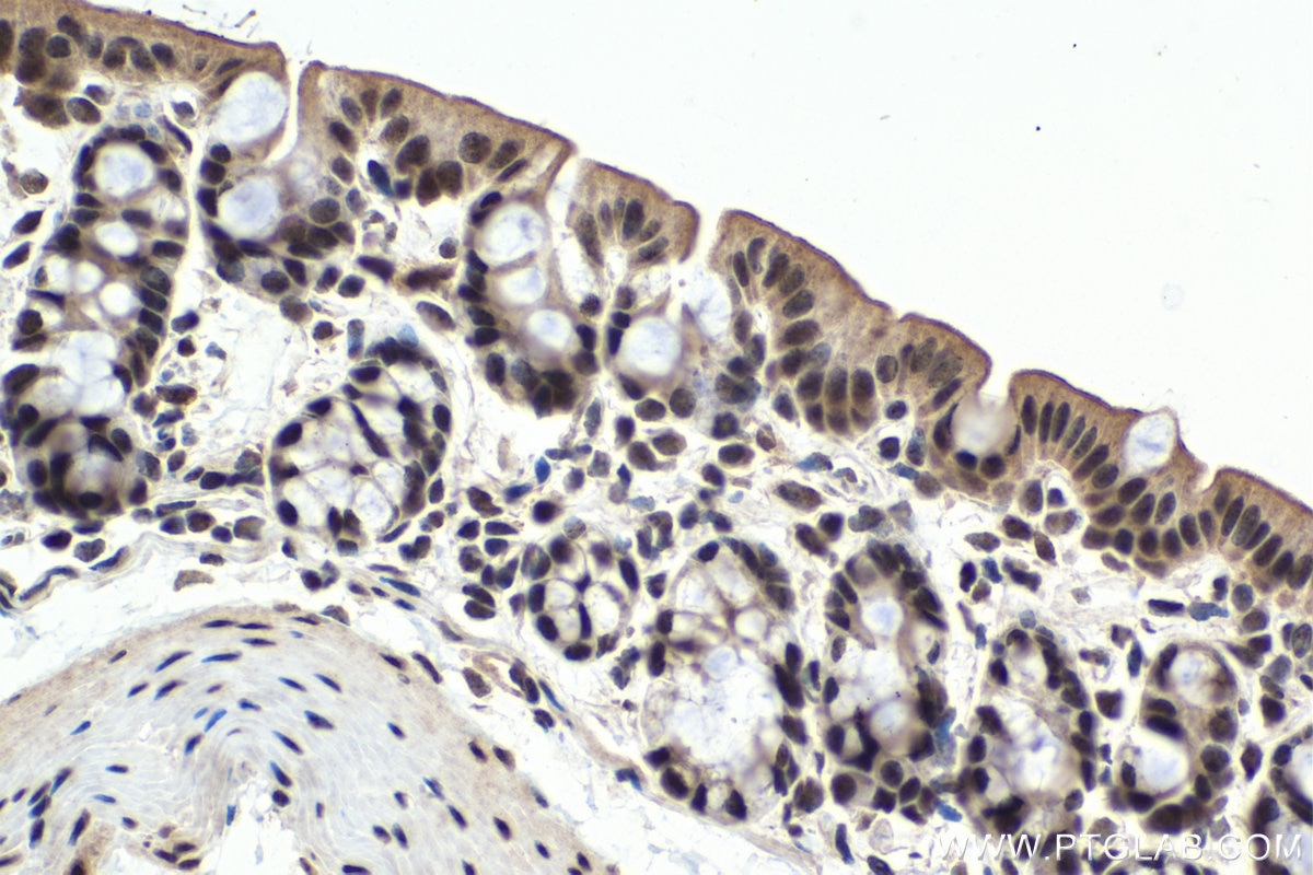 Immunohistochemistry (IHC) staining of mouse colon tissue using PARP1 Polyclonal antibody (13371-1-AP)