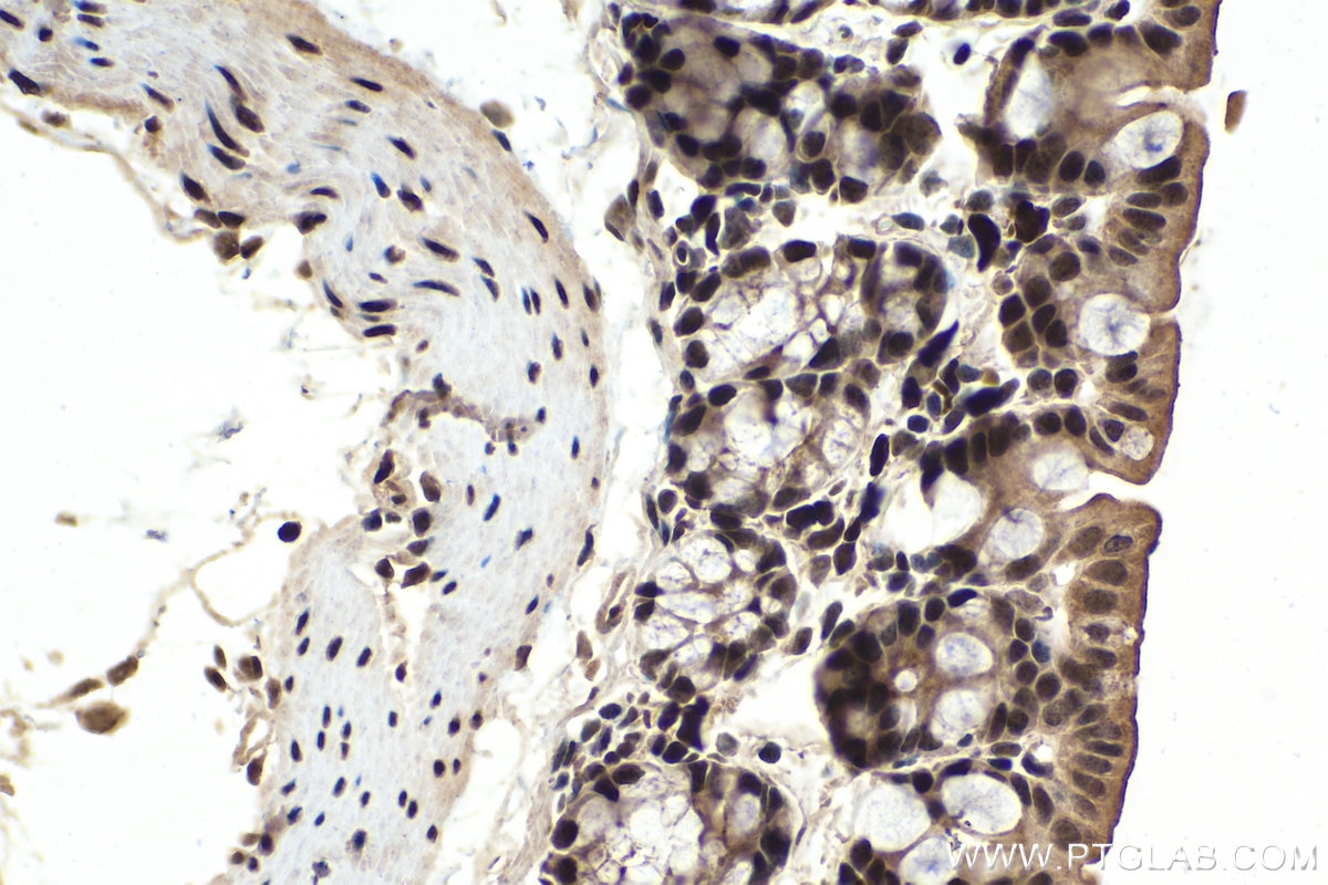 Immunohistochemistry (IHC) staining of mouse colon tissue using PARP1 Polyclonal antibody (13371-1-AP)