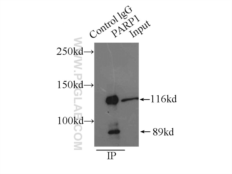 Immunoprecipitation (IP) experiment of K-562 cells using PARP1 Polyclonal antibody (13371-1-AP)