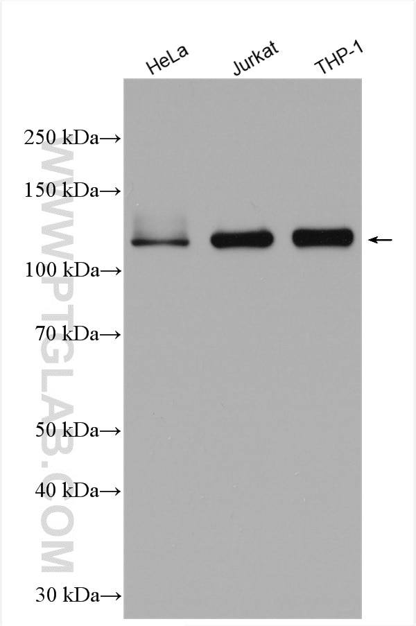 Western Blot (WB) analysis of various lysates using PARP1 Polyclonal antibody (13371-1-AP)