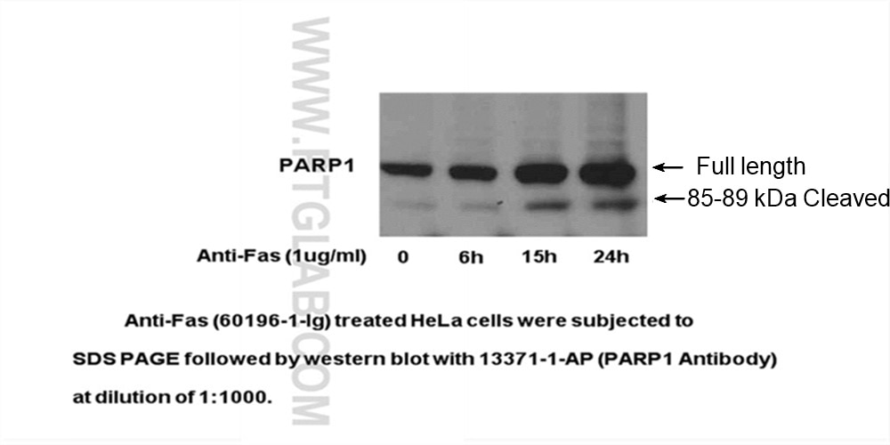 Western Blot (WB) analysis of HeLa cells using PARP1 Polyclonal antibody (13371-1-AP)
