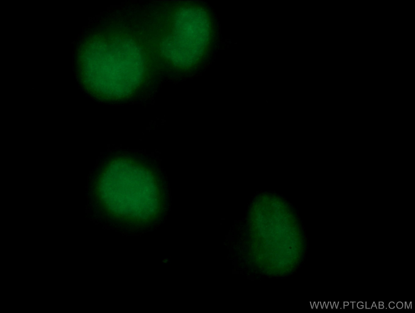 Immunofluorescence (IF) / fluorescent staining of Neuro-2a cells using PARP1 Polyclonal antibody (22999-1-AP)