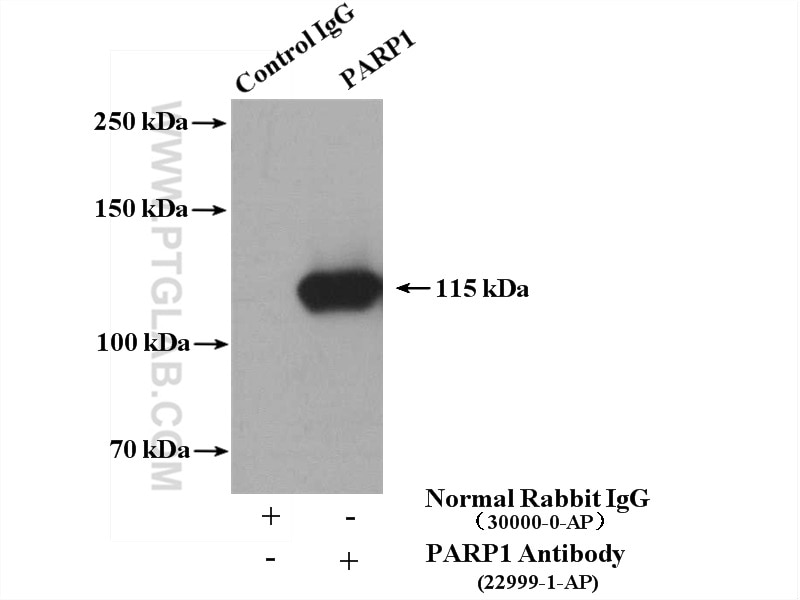 Immunoprecipitation (IP) experiment of K-562 cells using PARP1 Polyclonal antibody (22999-1-AP)