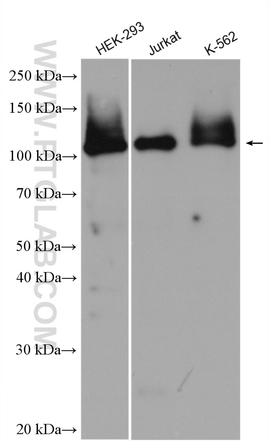 Western Blot (WB) analysis of various lysates using PARP1 Polyclonal antibody (22999-1-AP)