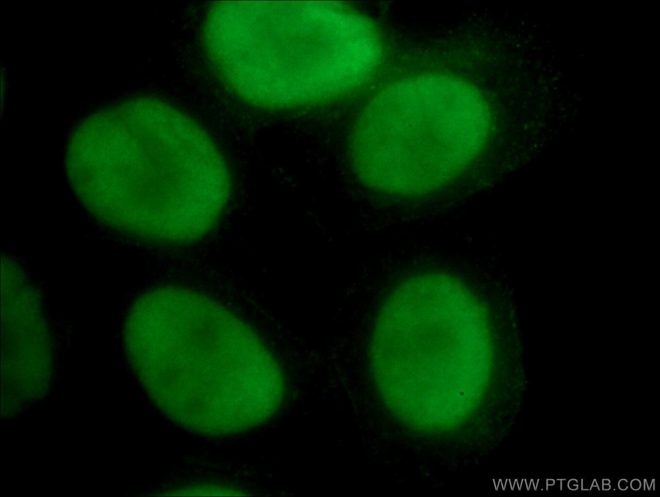 Immunofluorescence (IF) / fluorescent staining of HeLa cells using PARP1 Monoclonal antibody (66520-1-Ig)