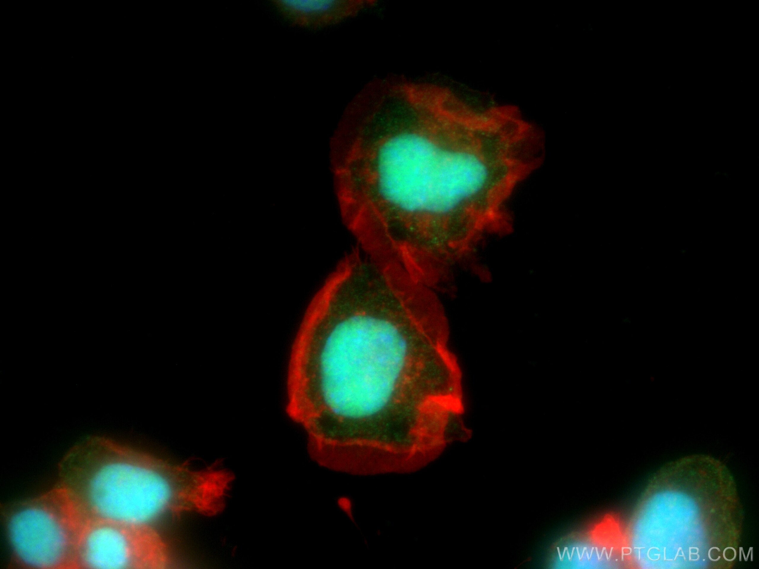 Immunofluorescence (IF) / fluorescent staining of Neuro-2a cells using PARP1 Monoclonal antibody (66520-1-Ig)