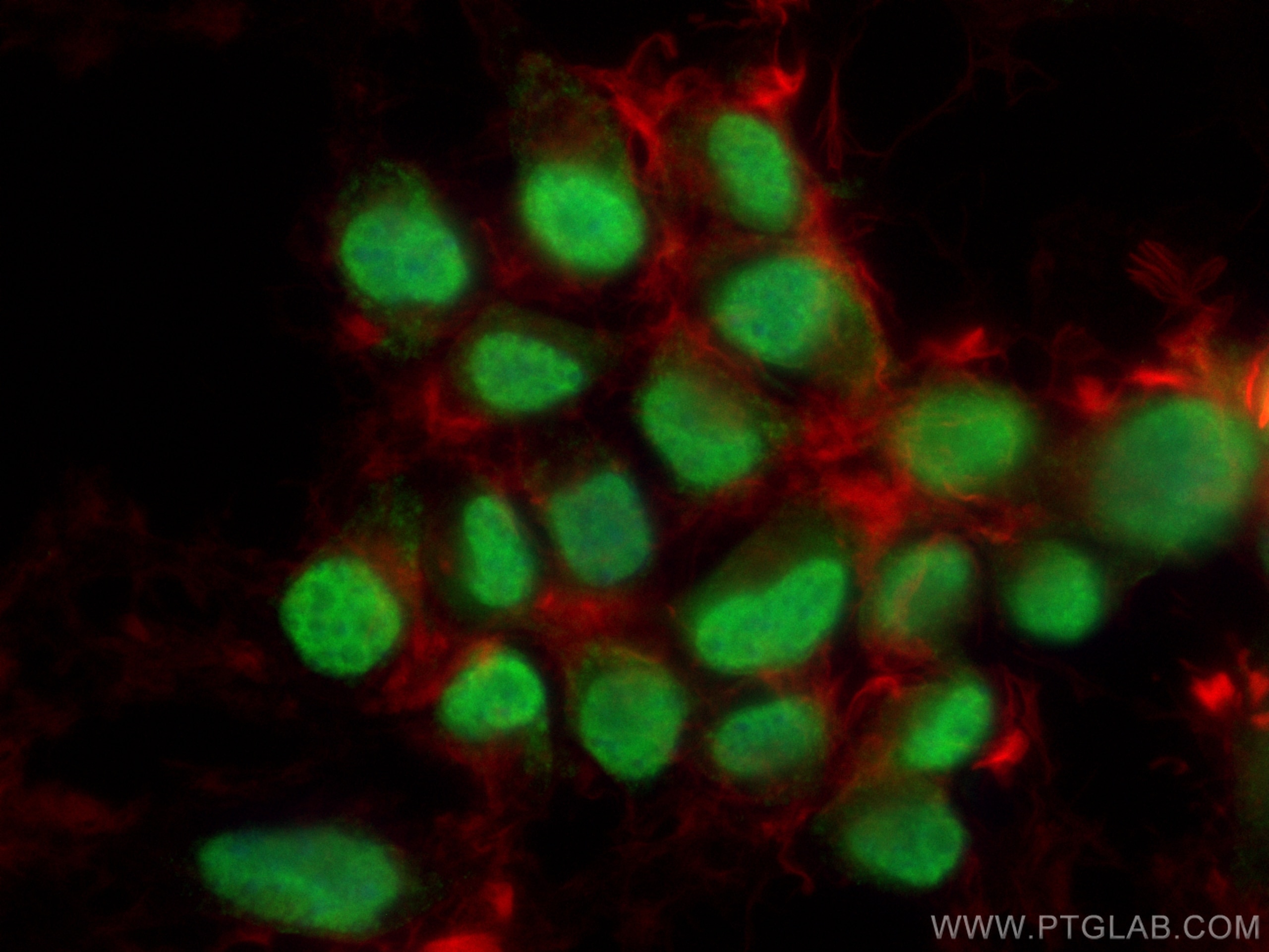 Immunofluorescence (IF) / fluorescent staining of Neuro-2a cells using PARP1 Monoclonal antibody (66520-1-Ig)