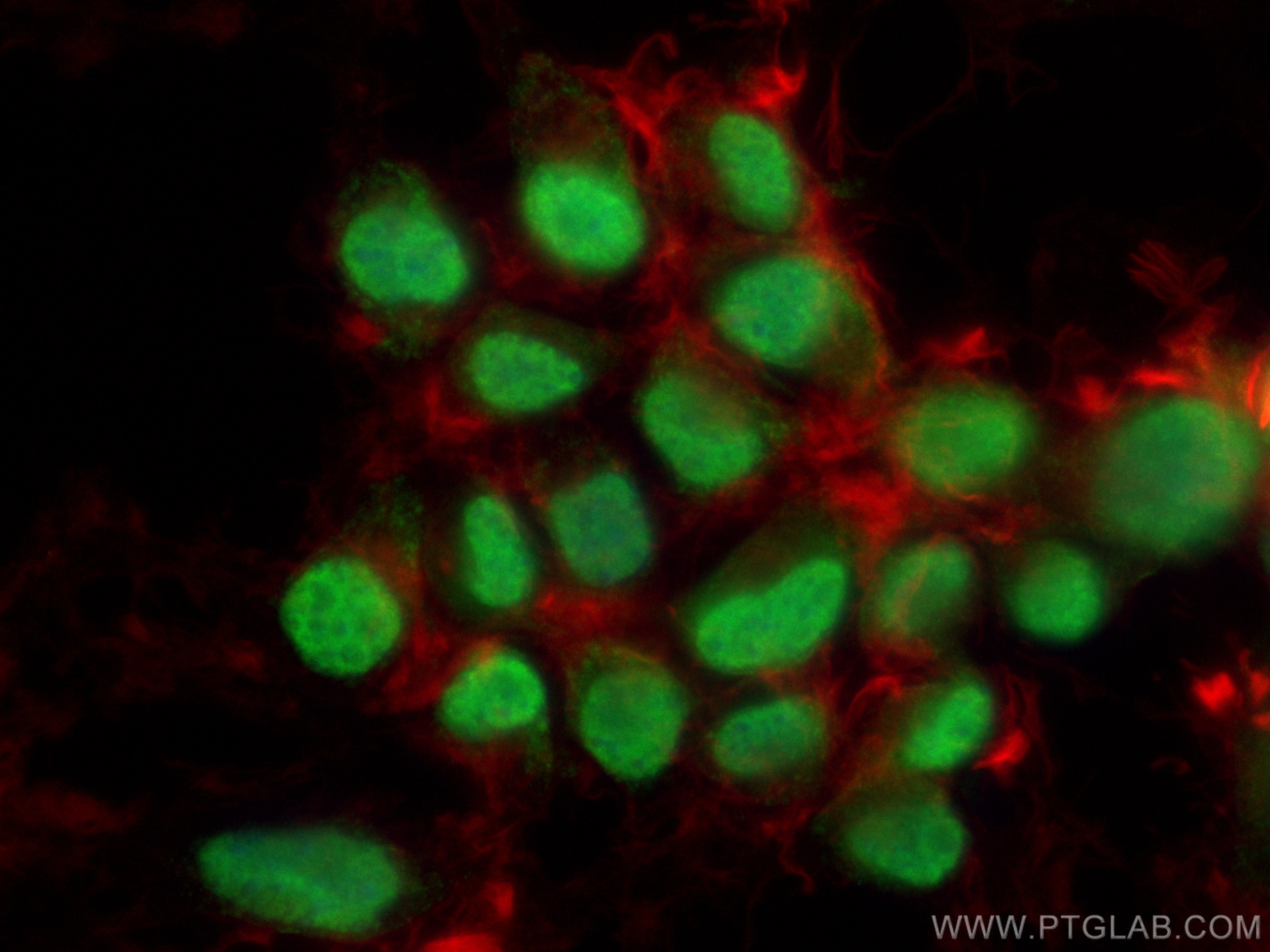 IF Staining of Neuro-2a using 66520-1-Ig