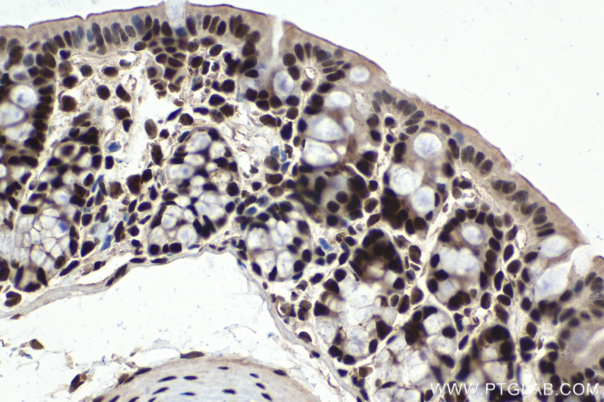 Immunohistochemistry (IHC) staining of mouse colon tissue using PARP1 Monoclonal antibody (66520-1-Ig)