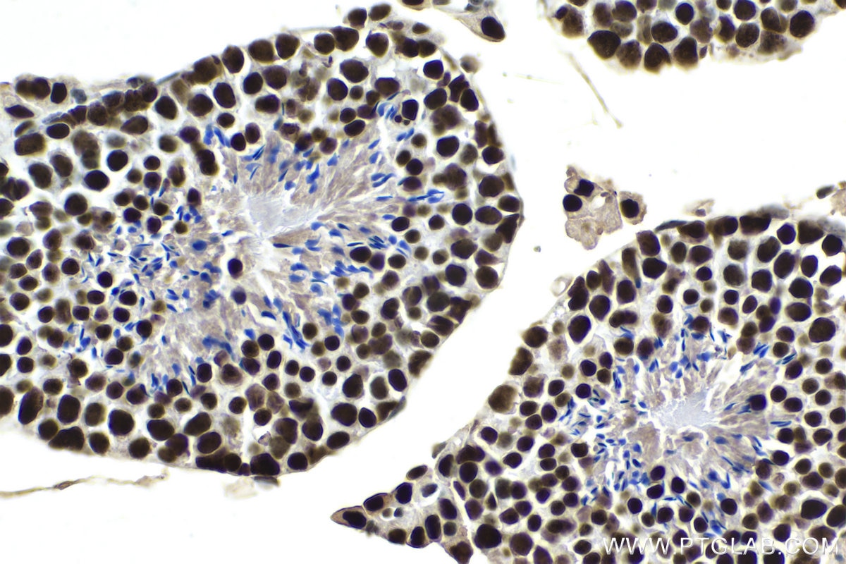 Immunohistochemistry (IHC) staining of mouse testis tissue using PARP1 Monoclonal antibody (66520-1-Ig)