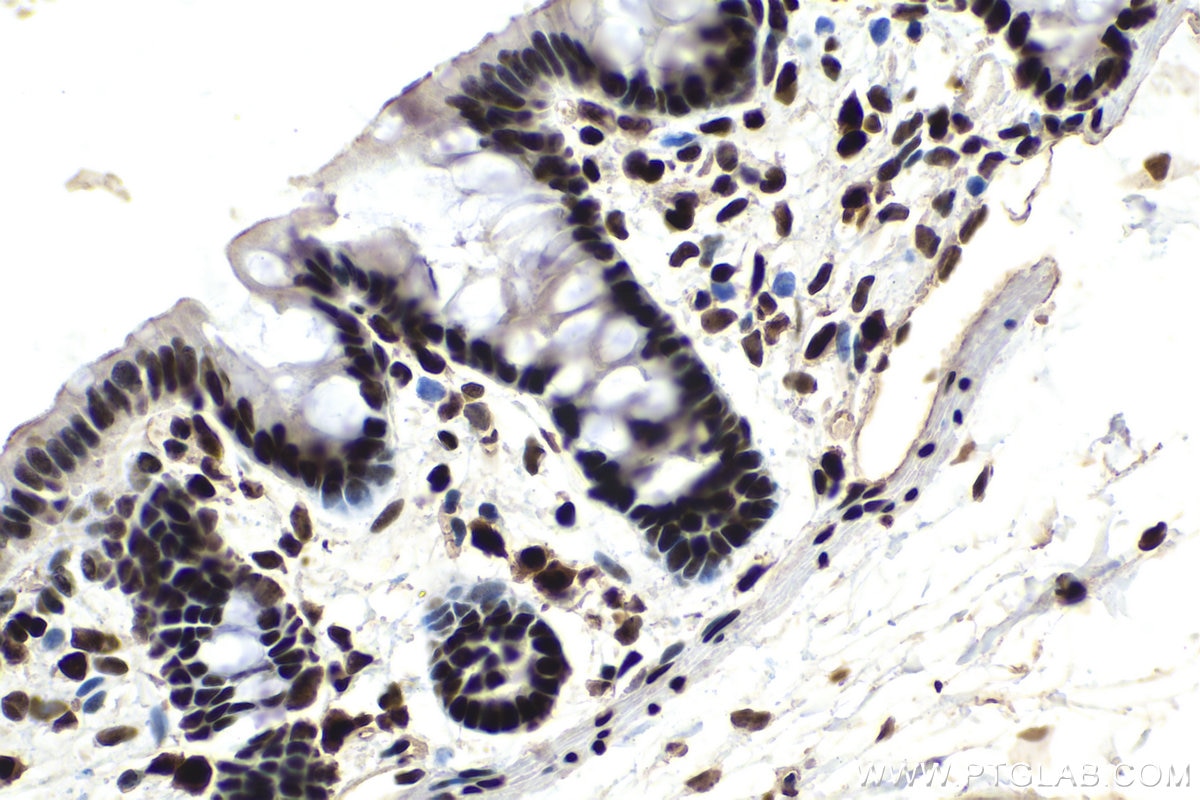 Immunohistochemistry (IHC) staining of rat colon tissue using PARP1 Monoclonal antibody (66520-1-Ig)