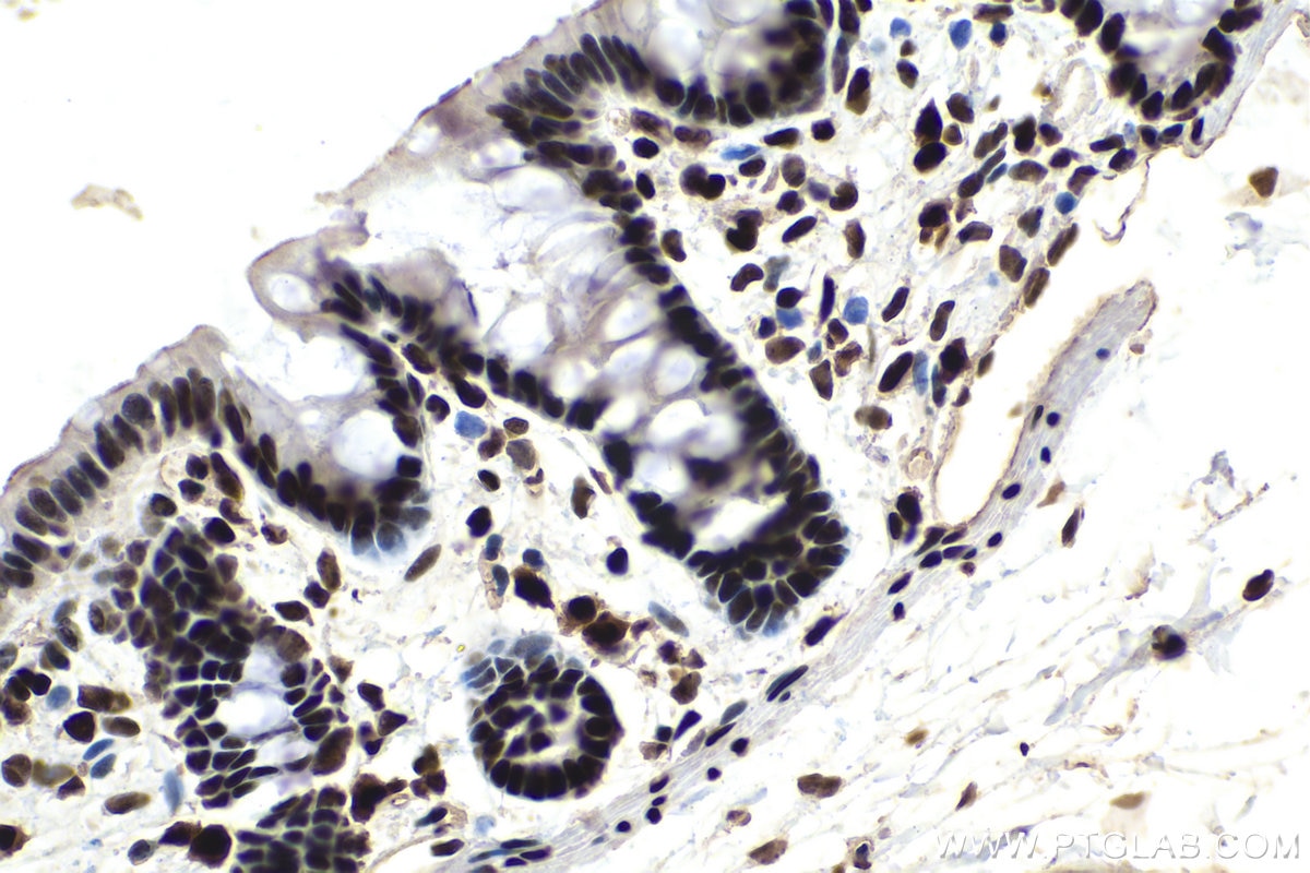 IHC staining of rat colon using 66520-1-Ig