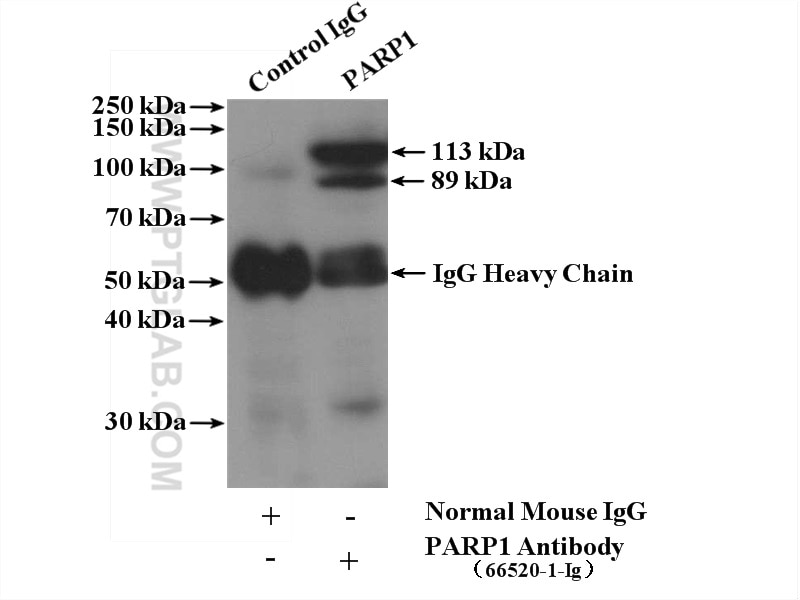 Immunoprecipitation (IP) experiment of K-562 cells using PARP1 Monoclonal antibody (66520-1-Ig)