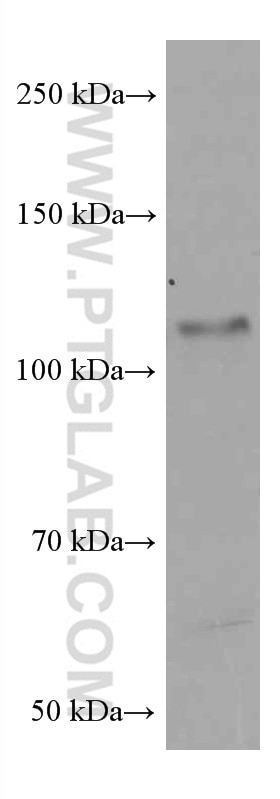 Western Blot (WB) analysis of RAW 264.7 cells using PARP1 Monoclonal antibody (66520-1-Ig)