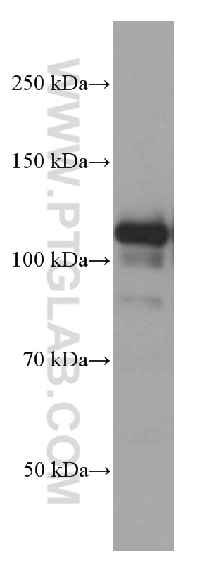Western Blot (WB) analysis of HeLa cells using PARP1 Monoclonal antibody (66520-1-Ig)