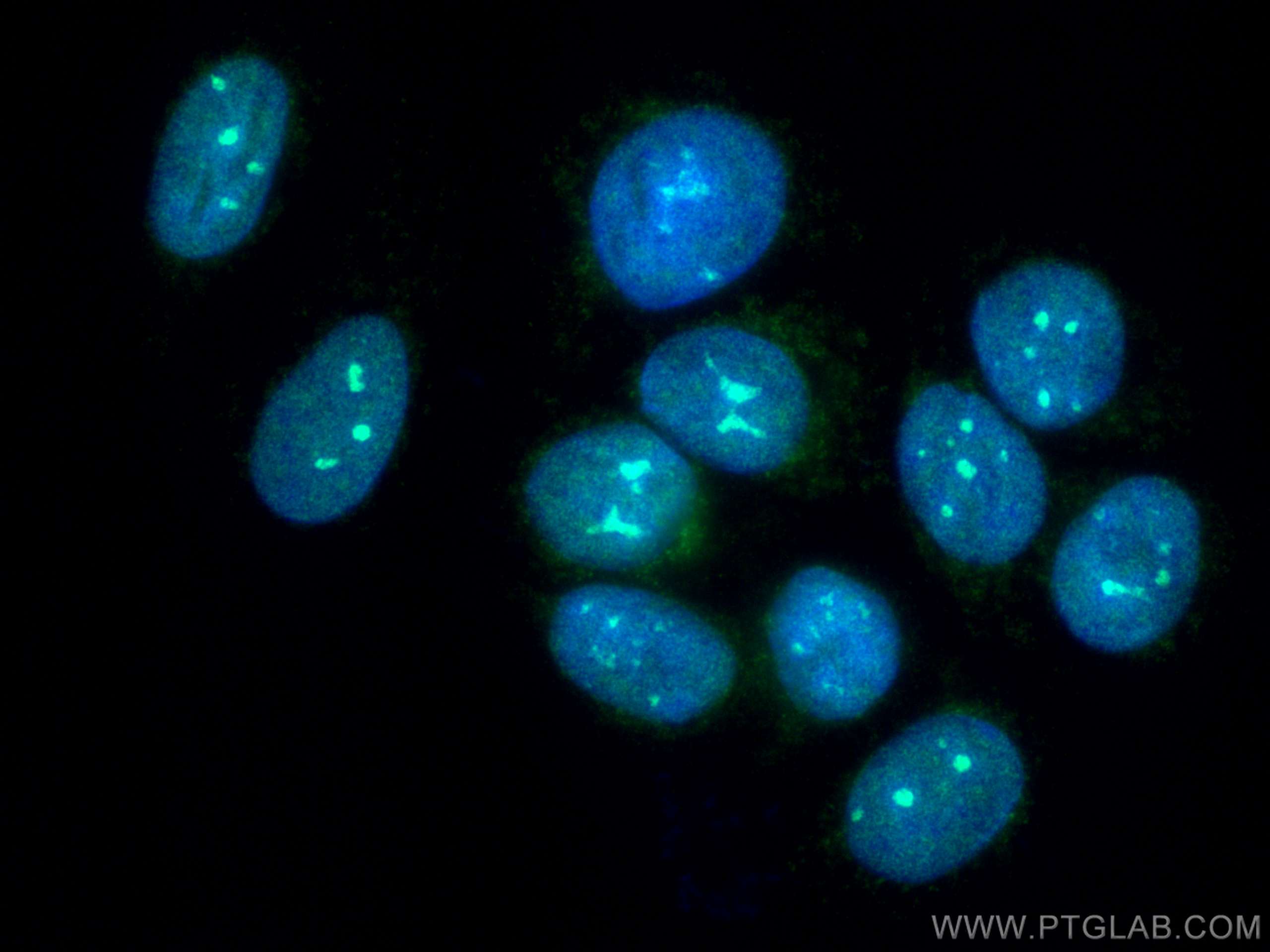 Immunofluorescence (IF) / fluorescent staining of MCF-7 cells using PARP1 Recombinant antibody (80174-1-RR)
