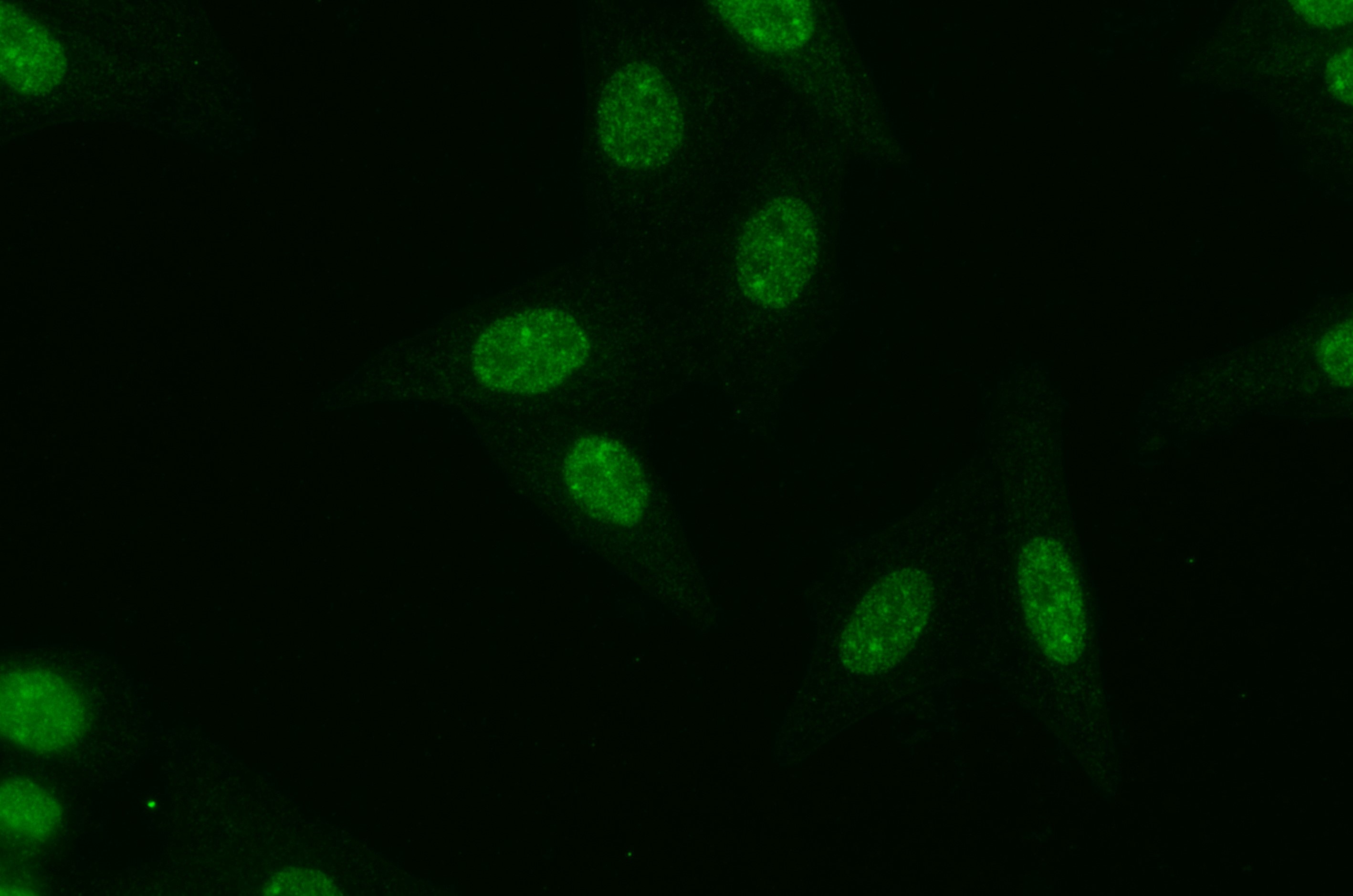 Immunofluorescence (IF) / fluorescent staining of HepG2 cells using PARP1 Recombinant antibody (80174-1-RR)