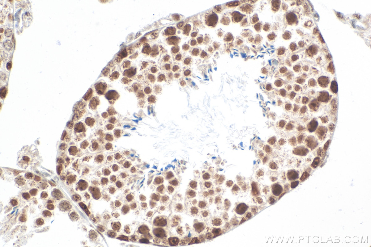 Immunohistochemistry (IHC) staining of mouse testis tissue using PARP1 Recombinant antibody (80174-1-RR)