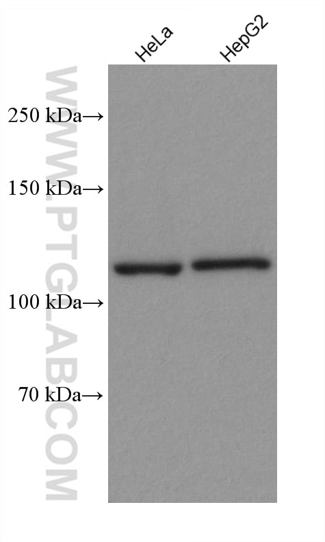 Western Blot (WB) analysis of various lysates using PARP1 Recombinant antibody (80174-1-RR)
