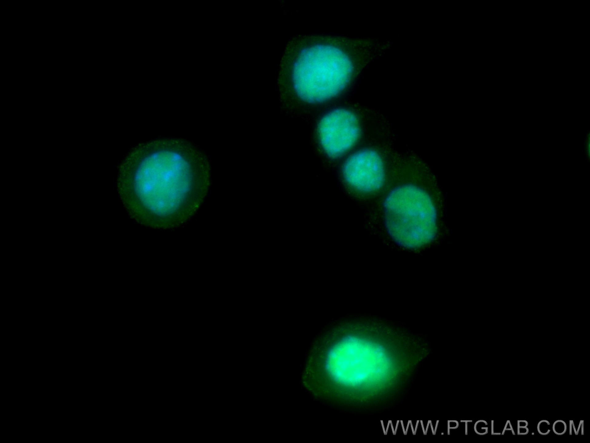 Immunofluorescence (IF) / fluorescent staining of Neuro-2a cells using CoraLite®488-conjugated PARP1 Monoclonal antibody (CL488-66520)