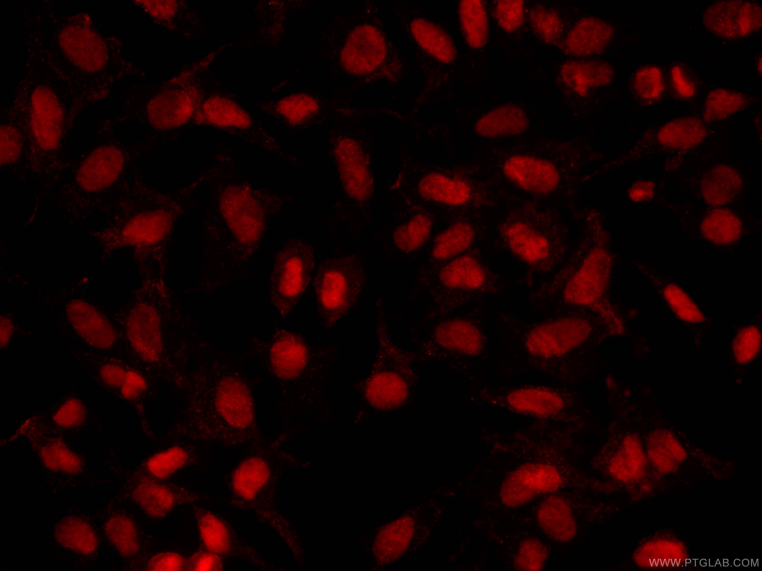 Immunofluorescence (IF) / fluorescent staining of HeLa cells using CoraLite®594-conjugated PARP1 Monoclonal antibody (CL594-66520)