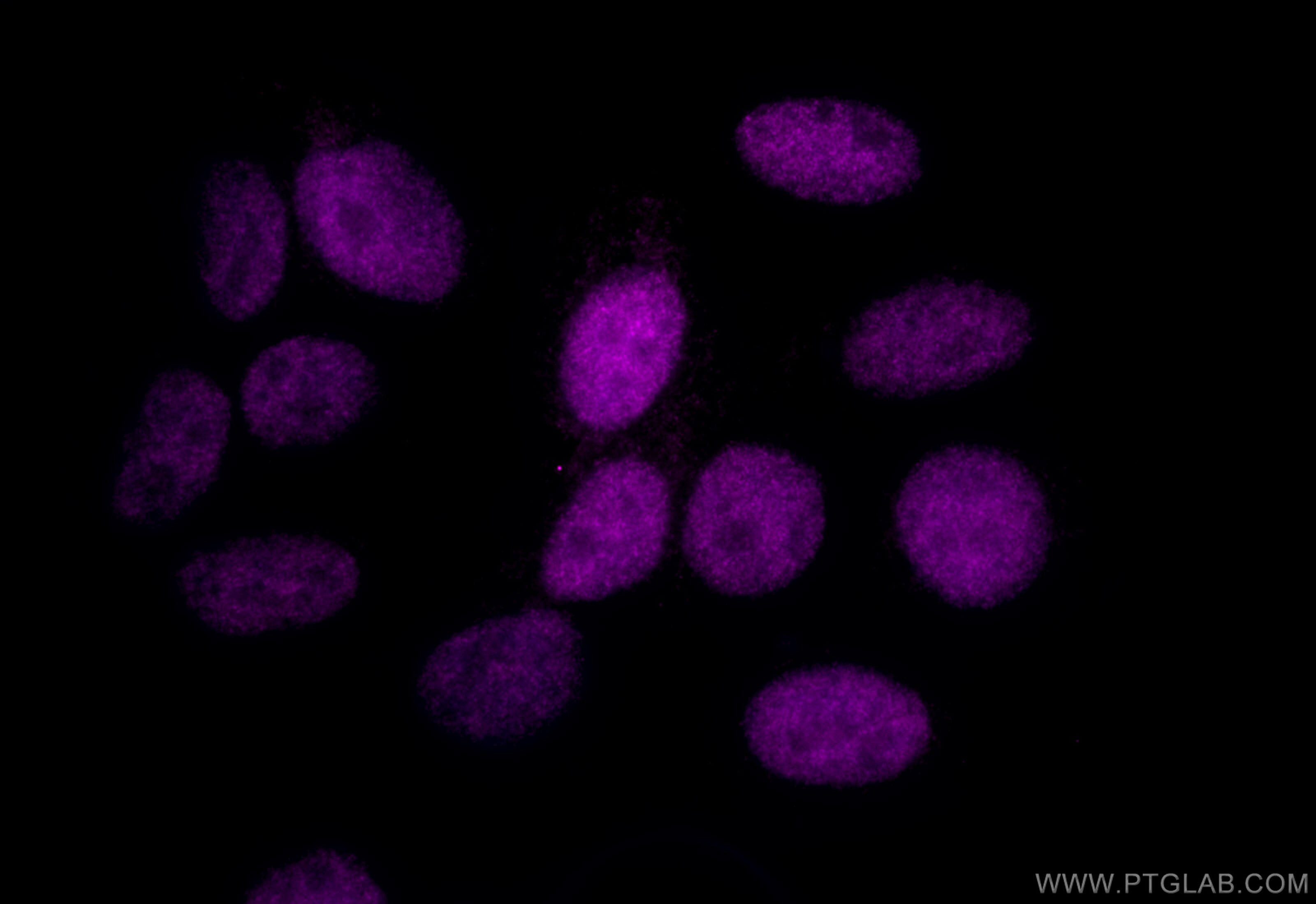 Immunofluorescence (IF) / fluorescent staining of HepG2 cells using CoraLite® Plus 647-conjugated PARP1 Polyclonal ant (CL647-13371)