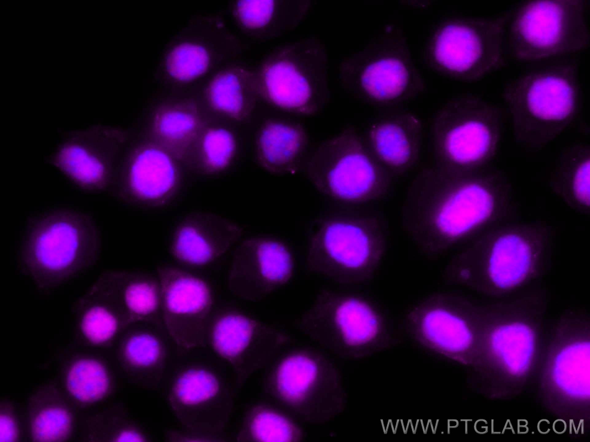 Immunofluorescence (IF) / fluorescent staining of Neuro-2a cells using CoraLite® Plus 647-conjugated PARP1 Monoclonal ant (CL647-66520)