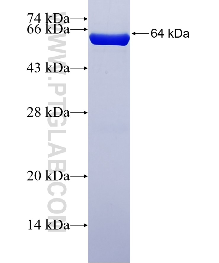 PARP1 fusion protein Ag4193 SDS-PAGE