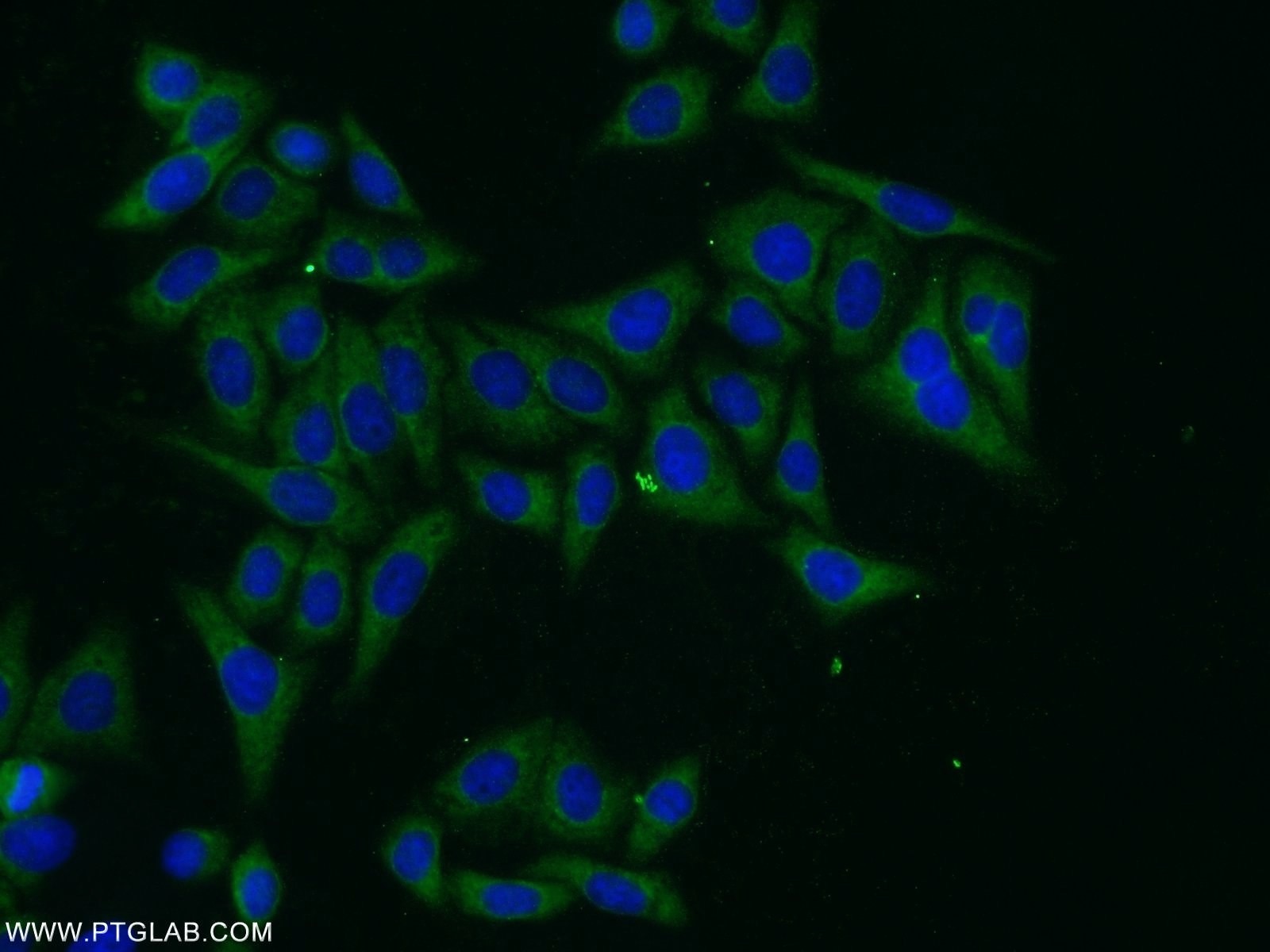 Immunofluorescence (IF) / fluorescent staining of HepG2 cells using PARP10 Polyclonal antibody (26072-1-AP)