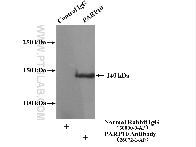 Immunoprecipitation (IP) experiment of Jurkat cells using PARP10 Polyclonal antibody (26072-1-AP)