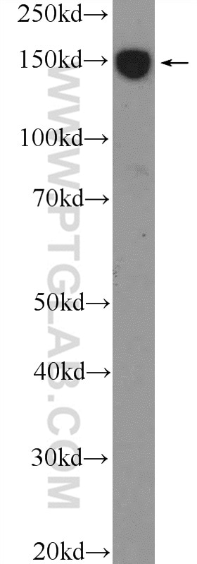 WB analysis of MCF-7 using 26072-1-AP