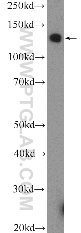 Western Blot (WB) analysis of Jurkat cells using PARP10 Polyclonal antibody (26072-1-AP)