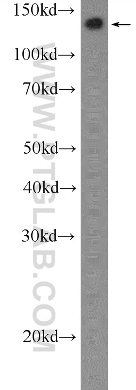 Western Blot (WB) analysis of HL-60 cells using PARP10 Polyclonal antibody (26072-1-AP)